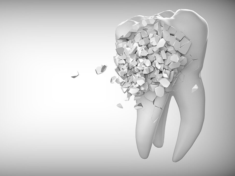 tooth, dentistry, that's funny-2874551.jpg